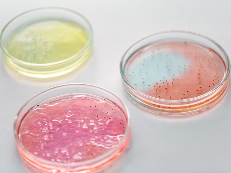 Close-Up Photograph of Petri Dishes with Different Colors