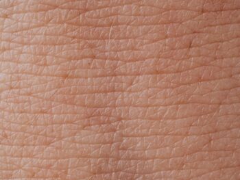 Close-up View Of Human Skin